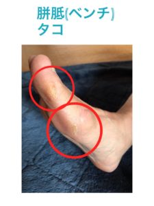 avifootcare5