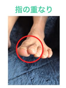 avifootcare7