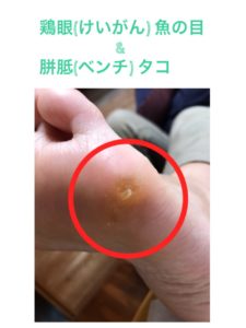 avifootcare9